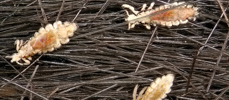Pediculosis y piojos