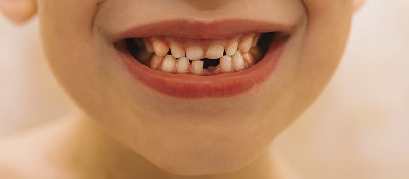 Niños El Ratoncito Pérez Dientes