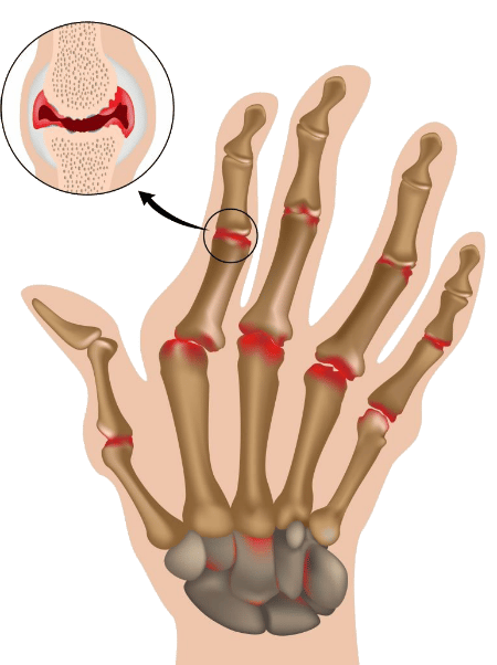 Aparato Locomotor