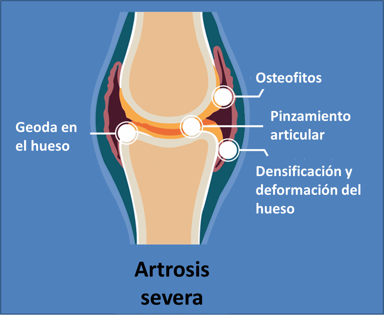 Qué es el aparato locomotor